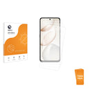 3-pack of Anti-Glare Screen Protectors for Honor X7d 5G
