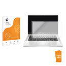 3-pack of Anti-Glare Screen Protectors for HP 14a-na2000
