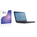Optic+ Blue Light Blocking Screen Protector for Dell Latitude 12 E7240 Non-Touch